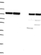 Lane 1: Marker [kDa] 250, 130, 95, 72, 55, 36, 28, 17, 10 | Lane 2: RT4 | Lane 3: U-251 MG | Lane 4: Human Plasma | Lane 5: Liver | Lane 6: Tonsil
