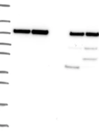 Lane 1: Marker [kDa] 250, 130, 95, 72, 55, 36, 28, 17, 10 | Lane 2: RT4 | Lane 3: U-251 MG | Lane 4: Human Plasma | Lane 5: Liver | Lane 6: Tonsil