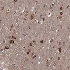 Anti-HABP4 Antibody