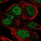Anti-ZNF561 Antibody