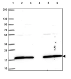 Lane 1: Marker [kDa] 250, 130, 95, 72, 55, 36, 28, 17, 10_br/_Lane 2: Human cell line RT-4_br/_Lane 3: Human cell line U-251 MG_br/_Lane 4: Human plasma_br/_Lane 5: Human Liver tissue_br/_Lane 6: Human Tonsil tissue
