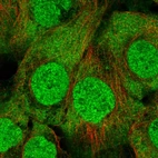 Immunofluorescent staining of human cell line A-431 shows localization to nucleus & cytosol.