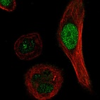 Anti-XRCC3 Antibody