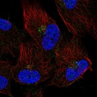 Anti-TMEM165 Antibody