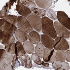 Immunohistochemical staining of human skeletal muscle shows high expression.