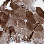 Immunohistochemical staining of human skeletal muscle shows high expression.