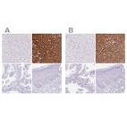 Immunohistochemical staining of human liver, pancreas, prostate and skin using Anti-PNLIP antibody HPA062430 (A) shows similar protein distribution across tissues to independent antibody HPA062494 (B).