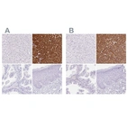 Immunohistochemical staining of human liver, pancreas, prostate and skin using Anti-PNLIP antibody HPA062430 (A) shows similar protein distribution across tissues to independent antibody HPA062494 (B).