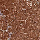 Immunohistochemical staining of human pancreas shows strong cytoplasmic positivity in exocrine glandular cells.