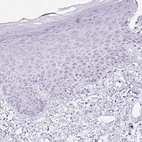 Immunohistochemical staining of human skin shows no positivity in squamous epithelial cells as expected.