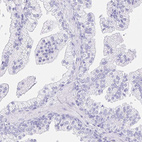 Immunohistochemical staining of human prostate shows no positivity in glandular cells as expected.