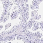 Immunohistochemical staining of human prostate shows no positivity in glandular cells as expected.
