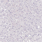 Immunohistochemical staining of human liver shows no positivity in hepatocytes as expected.