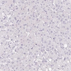 Immunohistochemical staining of human liver shows no positivity in hepatocytes as expected.