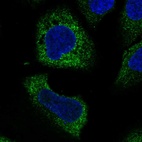 Anti-WISP3 Antibody