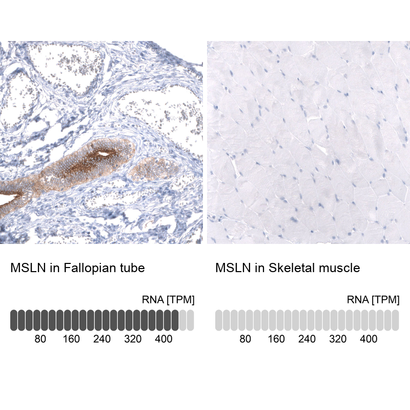 Anti-MSLN Antibody
