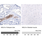 Anti-MSLN Antibody