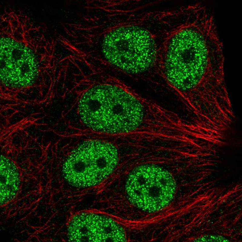Anti-ABI2 Antibody
