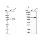 Western blot analysis using Anti-PES1 antibody HPA062439 (A) shows similar pattern to independent antibody HPA040210 (B).