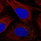 Immunofluorescent staining of human cell line U-2 OS shows localization to vesicles.
