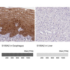 Anti-S100A2 Antibody