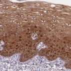 Immunohistochemical staining of human esophagus shows strong cytoplasmic and nuclear positivity in squamous epithelial cells.