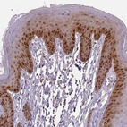 Immunohistochemical staining of human skin shows moderate to strong cytoplasmic and nuclear positivity in squamous epithelial cells.
