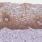 Immunohistochemical staining of human uterine cervix shows moderate to strong cytoplasmic and nuclear positivity in squamous epithelial cells.