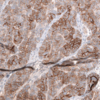 Anti-MSLN Antibody