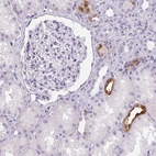 Immunohistochemical staining of human kidney shows moderate cytoplasmic and nuclear positivity in a subset of cells in tubules.