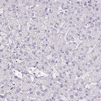 Anti-S100A2 Antibody