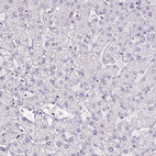 Immunohistochemical staining of human liver shows no positivity in hepatocytes as expected.