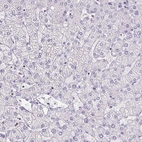 Immunohistochemical staining of human liver shows no positivity in hepatocytes as expected.