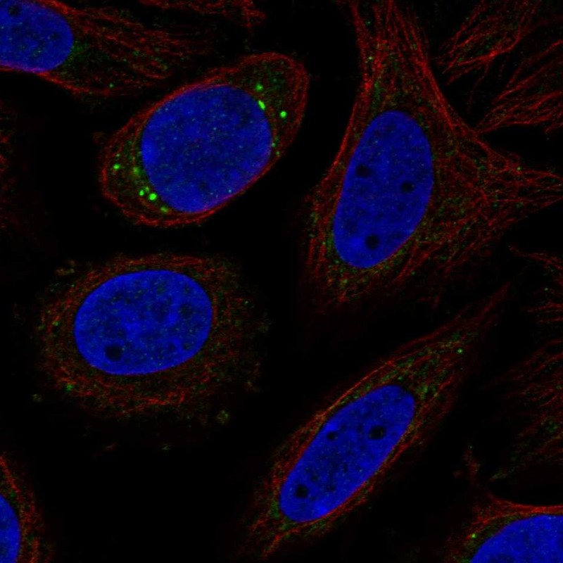 Anti-CYP27C1 Antibody