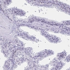 Immunohistochemical staining of human prostate shows low expression as expected.