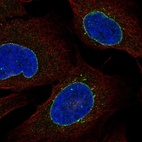 Immunofluorescent staining of human cell line U-2 OS shows localization to nuclear membrane & vesicles.