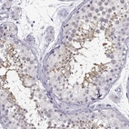 Immunohistochemical staining of human testis shows high expression.