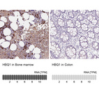 Anti-HBQ1 Antibody