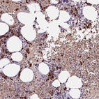 Immunohistochemical staining of human bone marrow shows high expression.