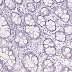 Immunohistochemical staining of human colon shows low expression as expected.