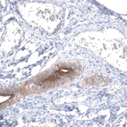 Immunohistochemical staining of human fallopian tube shows strong membranous positivity in glandular cells.