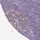 Anti-TCF3 Antibody