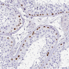 Anti-TCF3 Antibody