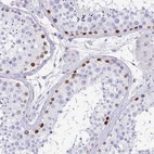 Immunohistochemical staining of human testis shows moderate to strong nuclear positivity in spermatogonia.