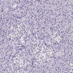 Anti-TCF3 Antibody