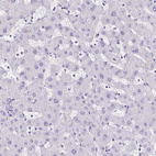Immunohistochemical staining of human liver shows no positivity in hepatocytes as expected.