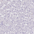 Anti-TCF3 Antibody