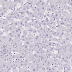 Immunohistochemical staining of human liver shows no positivity in hepatocytes as expected.