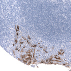 Anti-MSLN Antibody