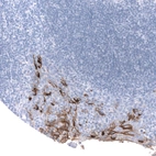 Immunohistochemical staining of human tonsil shows strong membranous positivity in squamous epithelial cells.